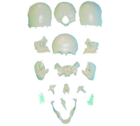 康人分离头颅骨散骨模型KAR/11117-2